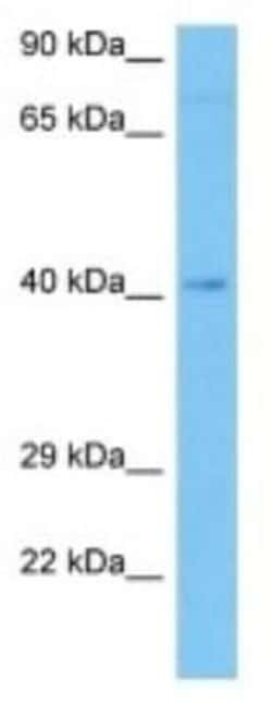 TAS2R123 Rabbit anti-Mouse, Polyclonal, Novus Biologicals 100 &mu;g | Buy Online | Novus Biologicals | Fisher Scientific